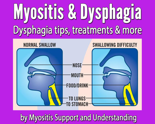 Myositis and Dysphagia