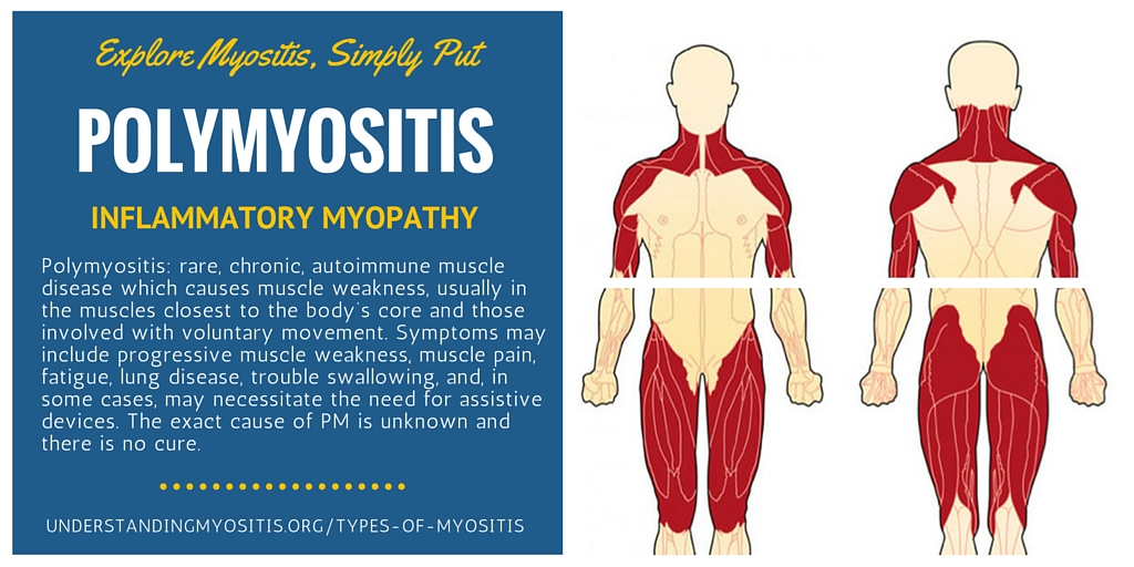 Polymyositis, Learn more from Myositis Support and Understanding